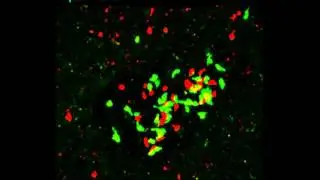 T-cell arrest within a TB-induced granuloma after antigen exposure