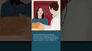 Lupus: A Hidden Disability | Merck Manuals