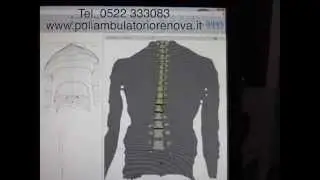 analisi strumentale podologica e posturale