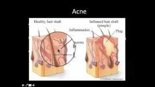 Skin Disorders