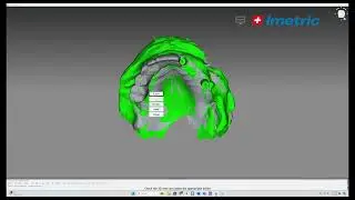 Imetric ICam Lab Training with Exocad
