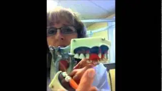 How to replace missing teeth.wmv
