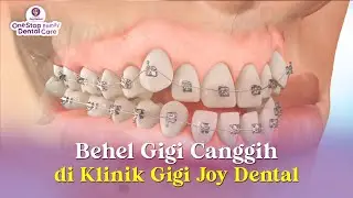 THE MOST ADVANCED BRACES IN THE WORLD ARE AT JOY DENTAL