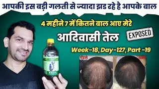 Adivasi Hair oil honest review | Adivasi Neelambari Herbal Hair Oil | Adivasi Hair Oil Review