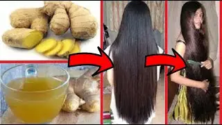 চুল পড়া বন্ধ করুন ৫টি প্রাকৃতিক উপায়। 5 natural ways to stop hair loss