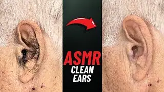 Ear cleaning ASMR with Clippers, NOT TALKING