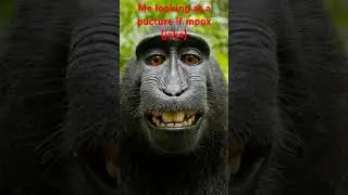 mpox=