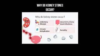 Why do kidney stones occur? #kidneystone #kidneyhealth #kidney #dehydration