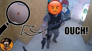 Airsoft CHEATER starts ARGUMENT after getting BLOODY ARM