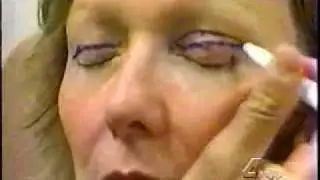 Dr. Asaadi Uses DermaBond to Stitch Skin