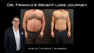 Dr. Franco's Skinny Shot Journey