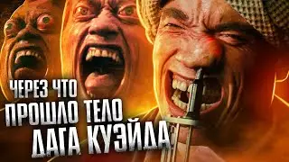 Через что прошло тело Дага Куэйда