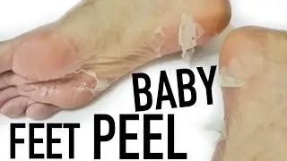 BABY FEET PEEL