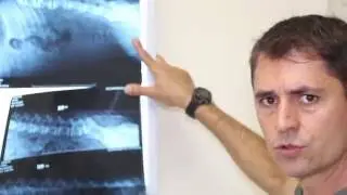 Displasia Coxofemoral e doenças genéticas