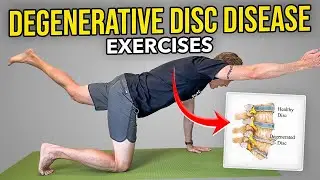 Degenerative Disc Disease Exercises (Lumbar Spine)