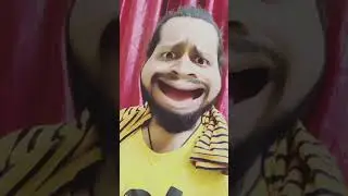 Marraige : Before & After 🤣🤣 #comedy #ytshorts #viral #shorts #shortsyoutube @content_dose7952