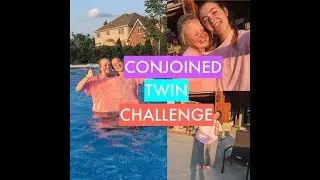 CONJOINED TWIN CHALLENGE