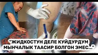"ЖИДКОСТУН деле куйдурдум МЫНЧАЛЫК таасир БОЛГОН ЭМЕС..."