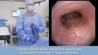 trūFreeze® Spray Cryotherapy Airway Procedure Video – Presented by Otis Rickman, DO