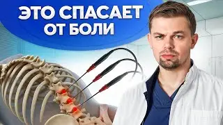 Как победить боль в спине? Радиочастотная денервация фасеточных суставов.