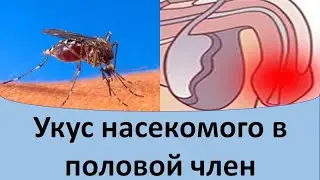 Укус насекомого в половой член.
