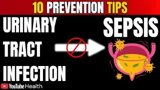 Doctor Reveals: How UTIs Lead to Sepsis (10 Prevention Tips)