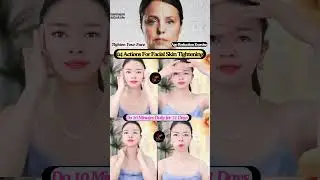 04 Actions For Facial Skin Tightening #yoga #facelift #botox #wrinkles #antiagingg #shorts