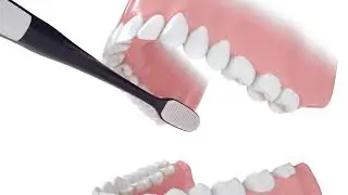 구강관리 회전법(최종수정)