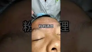 Best Satifying videos for Relaxation with Rat Tana Acne Spa =Short