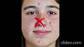 Easy Skin Retouching By Evoto #photoshop #photoediting