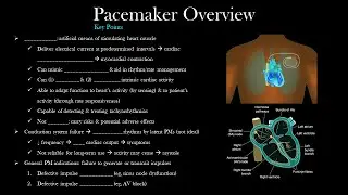 Pacemaker Overview | The EKG Guy - www.ekgguy.com