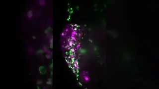 Macrophage kinetics of BCG-vaccine treated zebrafish bladder cancer xenografts.