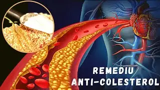 Remediu Natural cu Ovaz pentru Scaderea Colesterolului