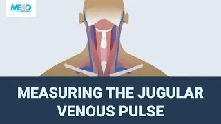 Measuring the jugular venous pulse