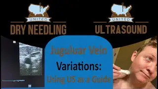 Jugular Variations Video