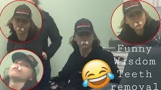 Funny wisdom teeth removal - The Young Family YAY