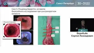 Endoscopy and Gastroenterology