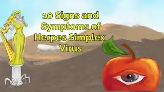 Herpes Simplex Virus: 10 Signs and Symptoms