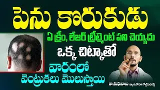 Home remedy for Alopecia Aerate | Penu Korukudu Tips In Telugu #hairtipstelugu | Hi Tv Life