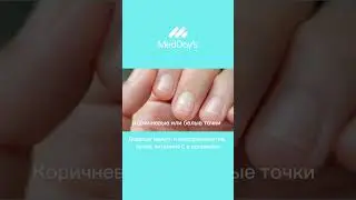 ♦️Что могут рассказать ногти о вашем здоровье #медицина #медицинскийтуризм #эковтурции #чекап