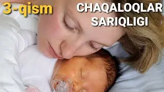 CHAQALOQLAR SARIQLIGI NEONATAL SARIQLIK, FIZIOLOGIK VA PATOLOGIK SARIQLIK DAVOLASH USULLARI (3-QISM)