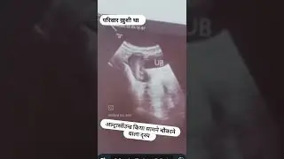 मेरे मुन्ना भूल ना जाना #sadstatus2023