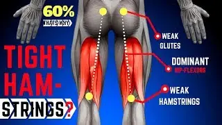 Why Your Hamstrings Are Always Tight | Anterior Pelvic Tilt | Fixing Up My Injuries