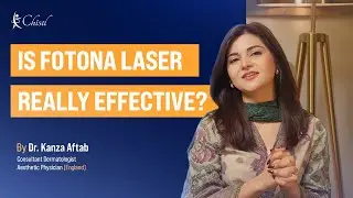 Is Fotona Laser Really Effective? Shocking Before & After Results Revealed!
