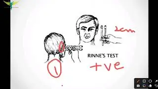 Rinne's test | Tuning Fork Tests - ENT