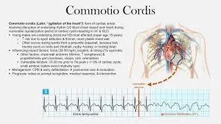 Commotio Cordis | The EKG Guy - www.ekgguy.com