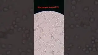 MİKROSKOP İNCELEMELERİMİZ (Bira mayası mantarı, bakteriler, paramesyum, soğan zarı hücreleri)