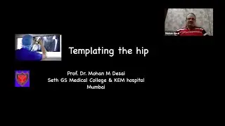 Templating of Hip Joint by  Dr Mohan Desai