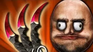 Top 7 Funniest & Best CS:GO Knife Unboxing Reactions