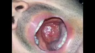 Me swallowing banana